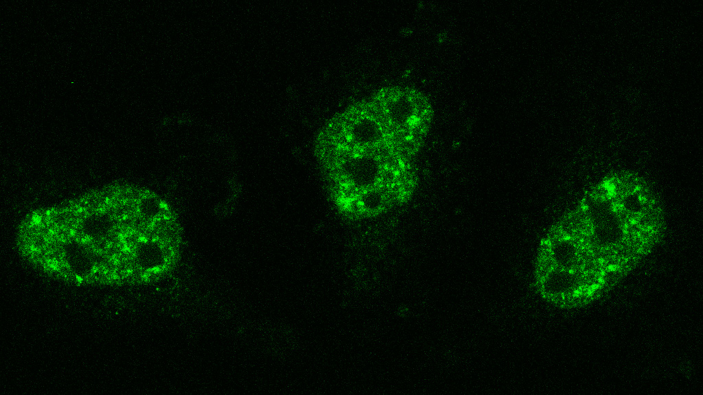 Das Protein TDP-43 (grün) bildet kleine Ansammlungen mit einer wichtigen regulatorischen Funktion im Zellkern. (Foto/©: Yelyzaveta Zadorozhna)