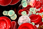 Abwehr bakterieller Sepsis (© Universitätsmedizin Mainz / Canva) Abwehr bakterieller Sepsis (© Universitätsmedizin Mainz / Canva)